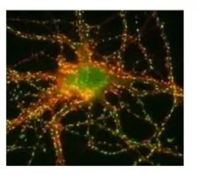 Anti-SynGAP antibody used in Immunocytochemistry/ Immunofluorescence (ICC/IF). GTX23344