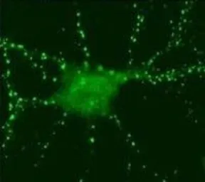 Anti-SynGAP antibody used in Immunocytochemistry/ Immunofluorescence (ICC/IF). GTX23344