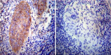 Anti-VAMP4 antibody used in IHC (Paraffin sections) (IHC-P). GTX23348
