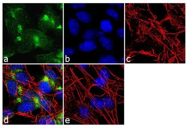 Anti-VAMP4 antibody used in Immunocytochemistry/ Immunofluorescence (ICC/IF). GTX23348