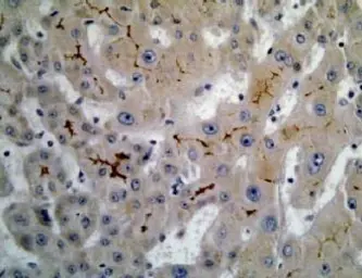 Anti-MRP6 antibody [M6II-31] used in Immunohistochemistry (IHC). GTX23381