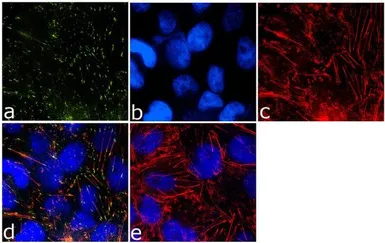 Anti-Caveolin 2 (phospho Tyr19) antibody used in Immunocytochemistry/ Immunofluorescence (ICC/IF). GTX23417