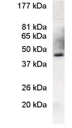 Anti-PREB antibody used in Western Blot (WB). GTX23422