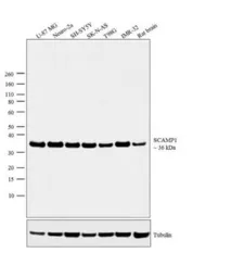 Anti-SCAMP 1 antibody used in Western Blot (WB). GTX23430