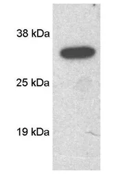 Anti-SCAMP 1 antibody used in Western Blot (WB). GTX23430