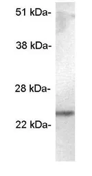 Anti-SCAMP 5 antibody used in Western Blot (WB). GTX23432