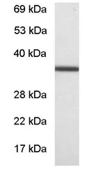 Anti-GNB1 antibody used in Western Blot (WB). GTX23433