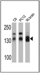 Anti-SAP97 antibody used in Western Blot (WB). GTX23437