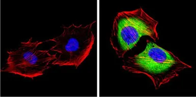 Anti-SAP97 antibody used in Immunocytochemistry/ Immunofluorescence (ICC/IF). GTX23437