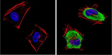 Anti-SAP97 antibody used in Immunocytochemistry/ Immunofluorescence (ICC/IF). GTX23437