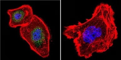 Anti-NFATC4 antibody used in Immunocytochemistry/ Immunofluorescence (ICC/IF). GTX23447