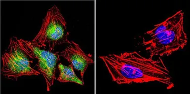 Anti-NFATC4 antibody used in Immunocytochemistry/ Immunofluorescence (ICC/IF). GTX23447