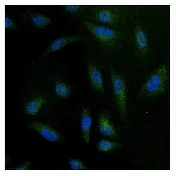 Anti-NFATC4 antibody used in Immunocytochemistry/ Immunofluorescence (ICC/IF). GTX23447