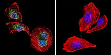 Anti-NFATC4 antibody used in Immunocytochemistry/ Immunofluorescence (ICC/IF). GTX23447