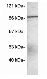 Anti-Mint3 antibody used in Western Blot (WB). GTX23450