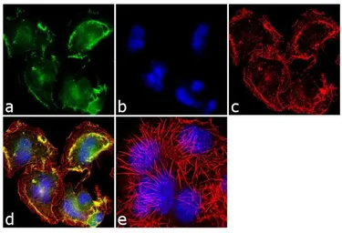 Anti-Mint3 antibody used in Immunocytochemistry/ Immunofluorescence (ICC/IF). GTX23450