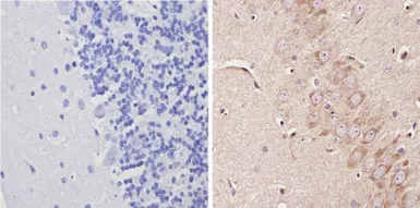 Anti-Adenosine A1 Receptor antibody used in IHC (Paraffin sections) (IHC-P). GTX23460