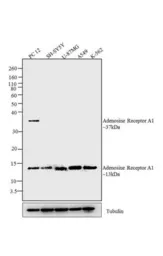 Anti-Adenosine A1 Receptor antibody used in Western Blot (WB). GTX23460
