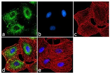 Anti-Adenosine A1 Receptor antibody used in Immunocytochemistry/ Immunofluorescence (ICC/IF). GTX23460