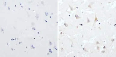 Anti-CPEB1 antibody used in IHC (Paraffin sections) (IHC-P). GTX23465