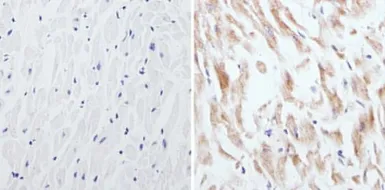 Anti-CPEB1 antibody used in IHC (Paraffin sections) (IHC-P). GTX23465