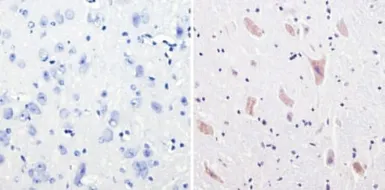 Anti-CPEB1 antibody used in IHC (Paraffin sections) (IHC-P). GTX23465