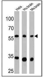 Anti-CPEB1 antibody used in Western Blot (WB). GTX23465
