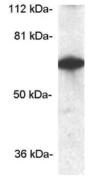 Anti-CPEB1 antibody used in Western Blot (WB). GTX23465