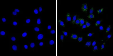 Anti-CPEB1 antibody used in Immunocytochemistry/ Immunofluorescence (ICC/IF). GTX23465