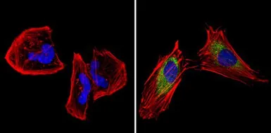Anti-CPEB1 antibody used in Immunocytochemistry/ Immunofluorescence (ICC/IF). GTX23465
