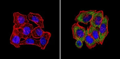 Anti-CPEB1 antibody used in Immunocytochemistry/ Immunofluorescence (ICC/IF). GTX23465