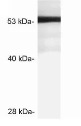 Anti-STARD3 antibody used in Western Blot (WB). GTX23478