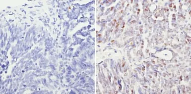 Anti-SIN3A antibody used in IHC (Paraffin sections) (IHC-P). GTX23479