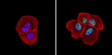 Anti-SIN3A antibody used in Immunocytochemistry/ Immunofluorescence (ICC/IF). GTX23479