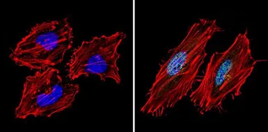 Anti-SIN3A antibody used in Immunocytochemistry/ Immunofluorescence (ICC/IF). GTX23479