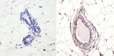 Anti-NCOR1 antibody used in IHC (Paraffin sections) (IHC-P). GTX23482