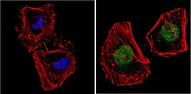 Anti-NCOR1 antibody used in Immunocytochemistry/ Immunofluorescence (ICC/IF). GTX23482
