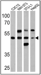 Anti-PPAR alpha (phospho Ser12) antibody used in Western Blot (WB). GTX23484