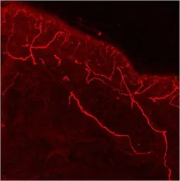 Anti-VR1/ TRPV1 antibody used in IHC (Frozen sections) (IHC-Fr). GTX23487