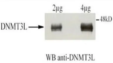 Anti-DNMT3L antibody used in Immunoprecipitation (IP). GTX23493