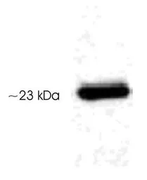 Anti-Serotonin N-AT antibody used in Western Blot (WB). GTX23506