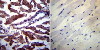 Anti-Calpastatin antibody [2G11D6] used in IHC (Paraffin sections) (IHC-P). GTX23515