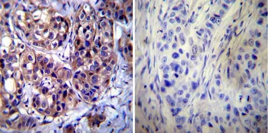 Anti-Calpastatin antibody [2G11D6] used in IHC (Paraffin sections) (IHC-P). GTX23515