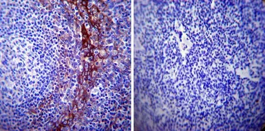 Anti-Calpastatin antibody [2G11D6] used in IHC (Paraffin sections) (IHC-P). GTX23515