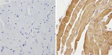 Anti-Calsequestrin antibody used in IHC (Paraffin sections) (IHC-P). GTX23516