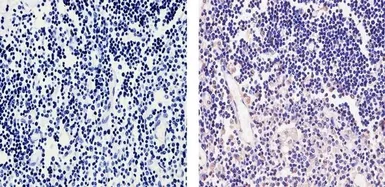 Anti-CaMKIV antibody used in IHC (Paraffin sections) (IHC-P). GTX23557