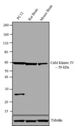 Anti-CaMKIV antibody used in Western Blot (WB). GTX23557