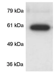Anti-CaMKIV antibody used in Western Blot (WB). GTX23557