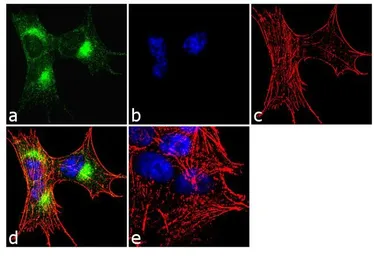 Anti-CaMKIV antibody used in Immunocytochemistry/ Immunofluorescence (ICC/IF). GTX23557