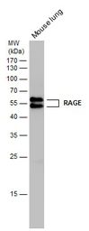 Anti-RAGE antibody used in Western Blot (WB). GTX23611